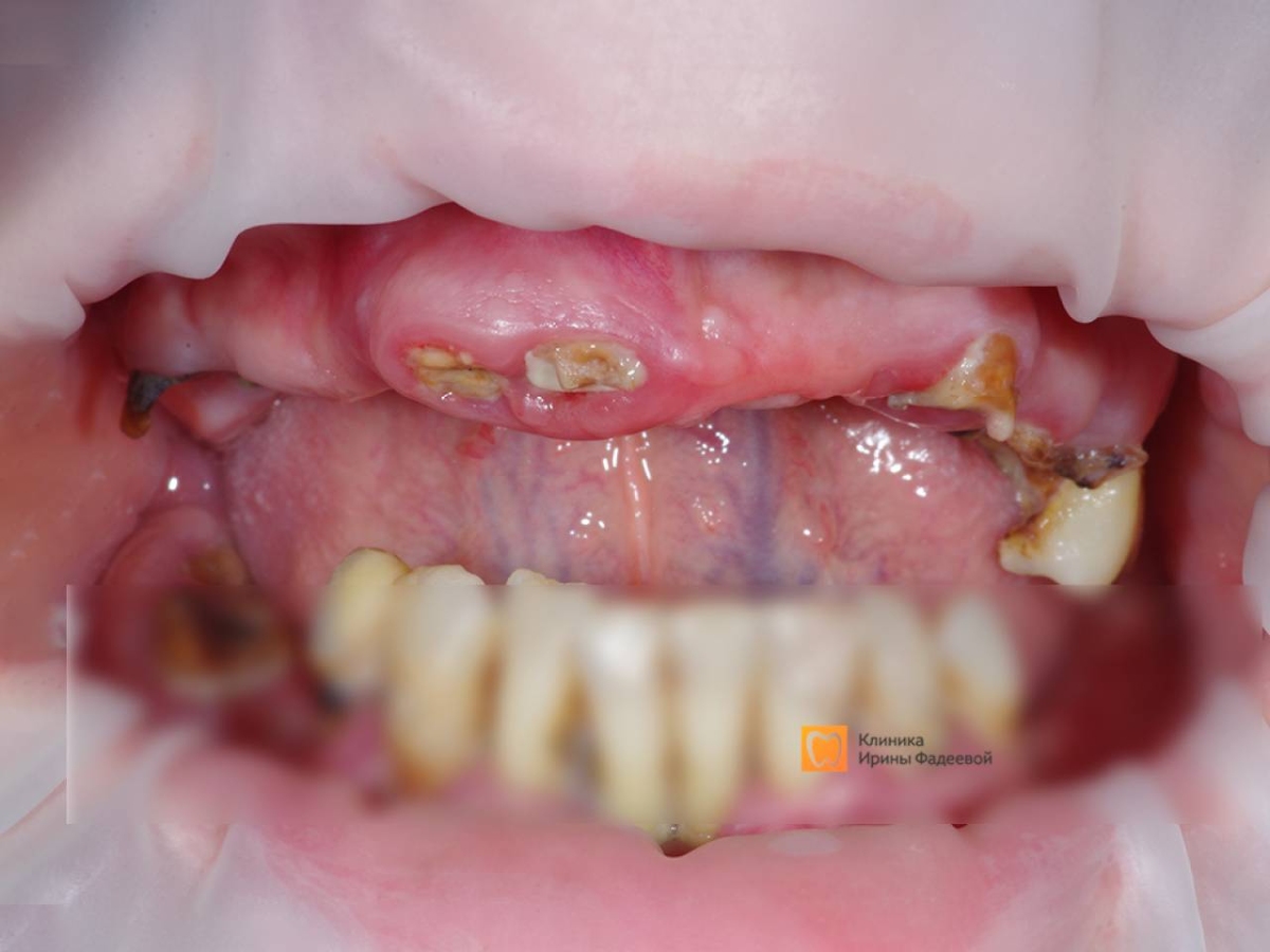 Кейсы Тотальная реабилитация — до