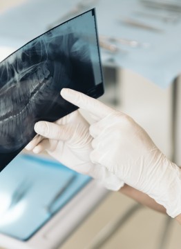 Исследование ТРГ