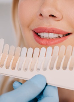 Отбеливание зубов Zoom